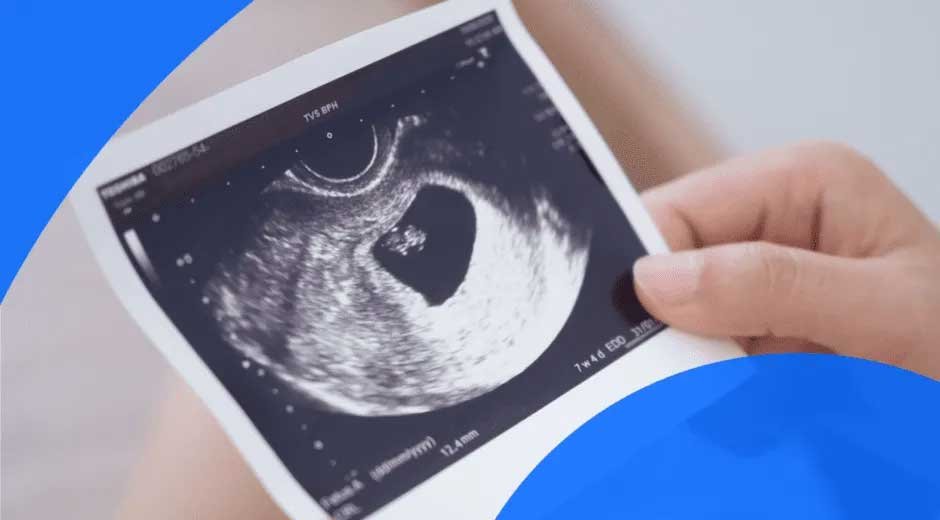Understanding The Role of Regular Ultrasound Scans for Expectant Moms: Why You Need Regular Scans